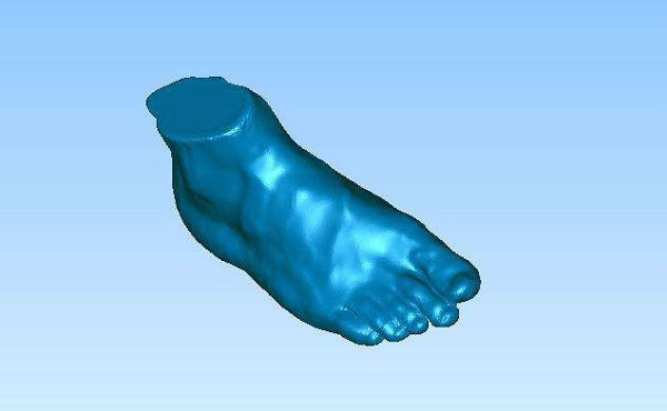 医疗3D打印机定制矫正器(图4) 医疗3D打印机定制矫正器(图4)