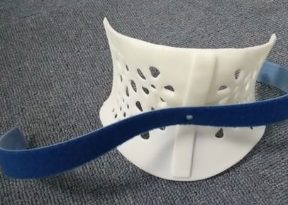 医疗3D打印机定制矫正器(图2) 医疗3D打印机定制矫正器(图2)