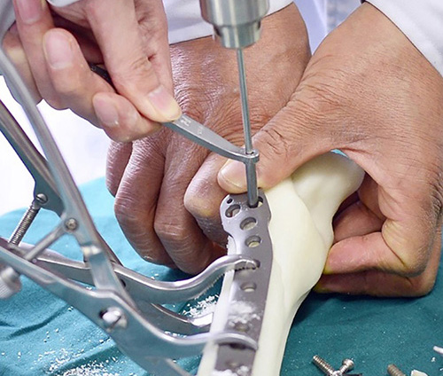 3D打印技术在骨科的实际应用有哪些?(图2) 3D打印技术在骨科的实际应用有哪些?(图2)