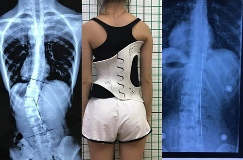 3D打印技术在骨科的实际应用有哪些?(图4) 3D打印技术在骨科的实际应用有哪些?(图4)